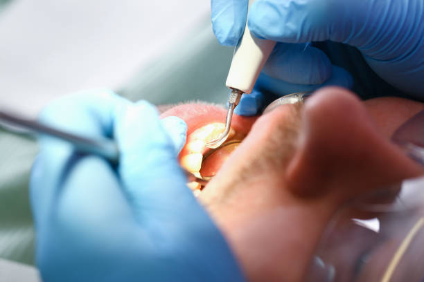 Best Weekend Emergency Dentist in Bowling Green, OH