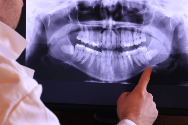Best Emergency Gum Treatment in Bowling Green, OH