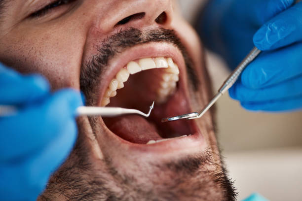 Best Same-Day Emergency Dental Services in Bowling Green, OH